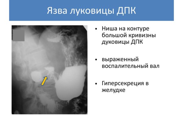 Кракен маркет дарнет только через тор